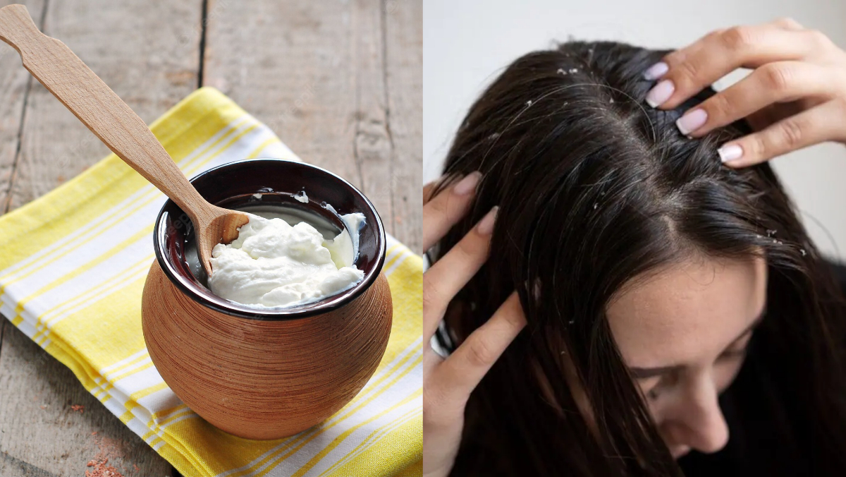 Curd is the cure for every hair problem: बालों की हर समस्‍या का इलाज है दही ,जानिए कैसे करना है इसका इस्तेमाल