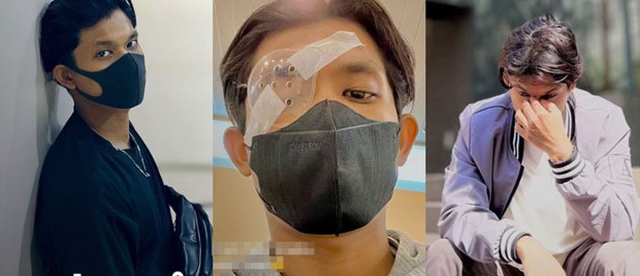 Rubbed his eyes: इस लड़के ने अपनी आंखों को इतना रगड़ा, कार्निया का करवाना पड़ा ट्रांसप्‍लांट