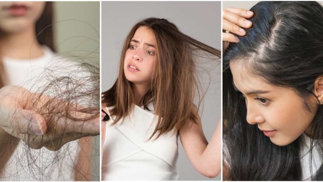 Hair Care in Mansoon: मानसून में बालों को टूटने और झड़ने से बचाएंगे ये 7 उपाय, जरूर ट्राई करें