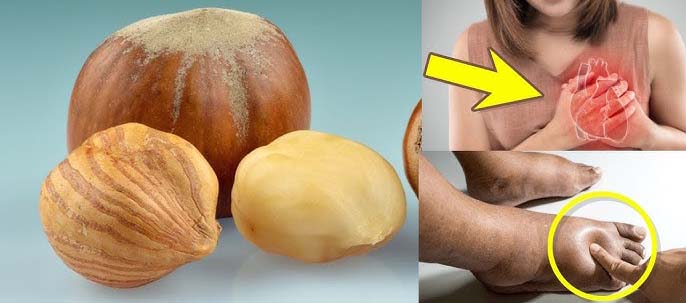 Hazel nuts Benefits: फायदे में बादाम-अखरोट को पीछे छोड़ देता है हेजल नट्स, कमजोर शरीर में फूंक देता है जान